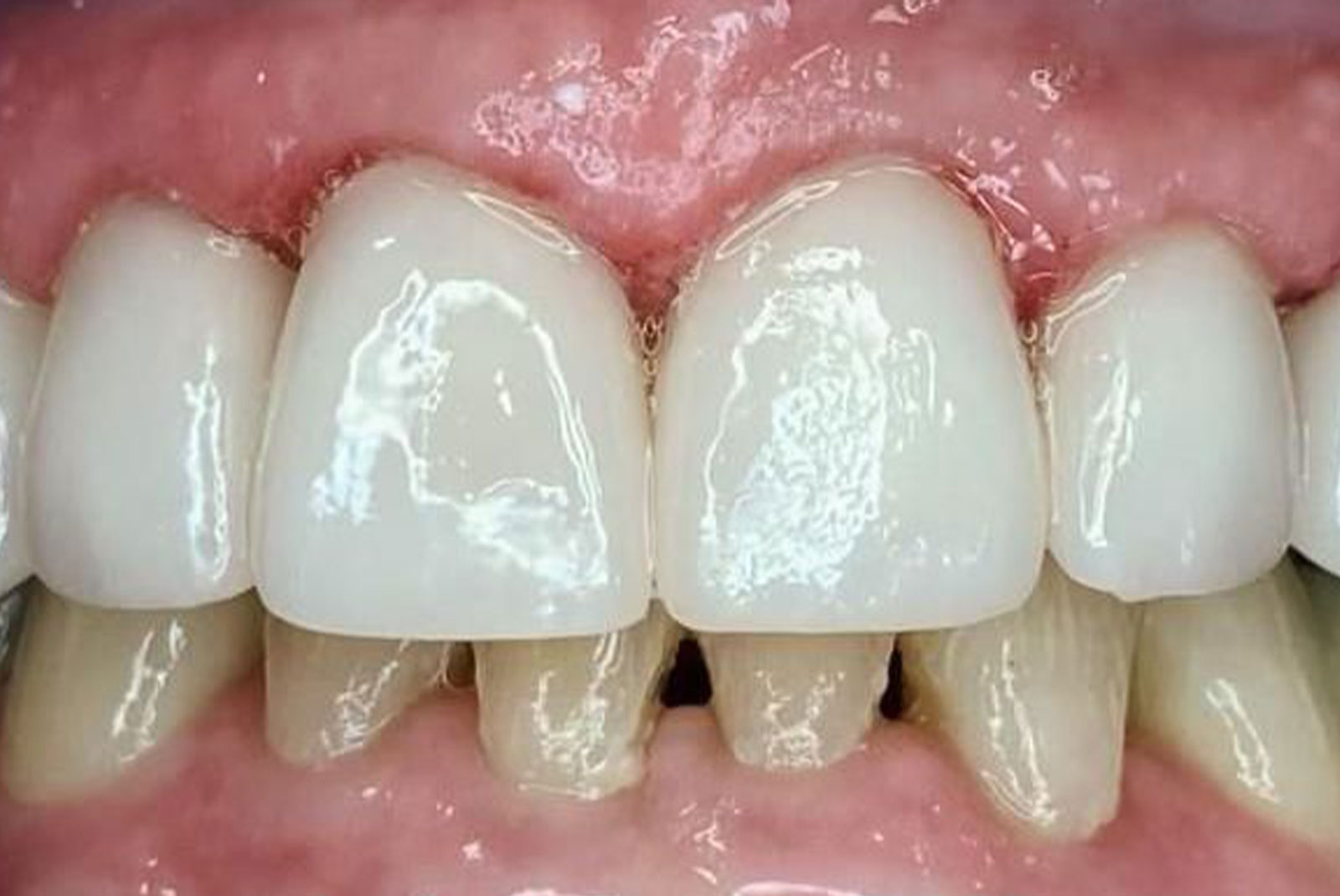 Before and After procedure images up close