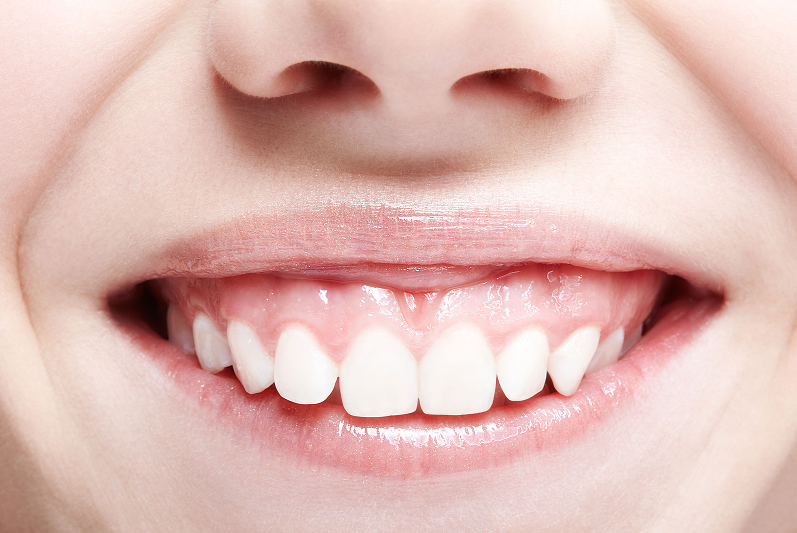 close up of person that has a gummy smile