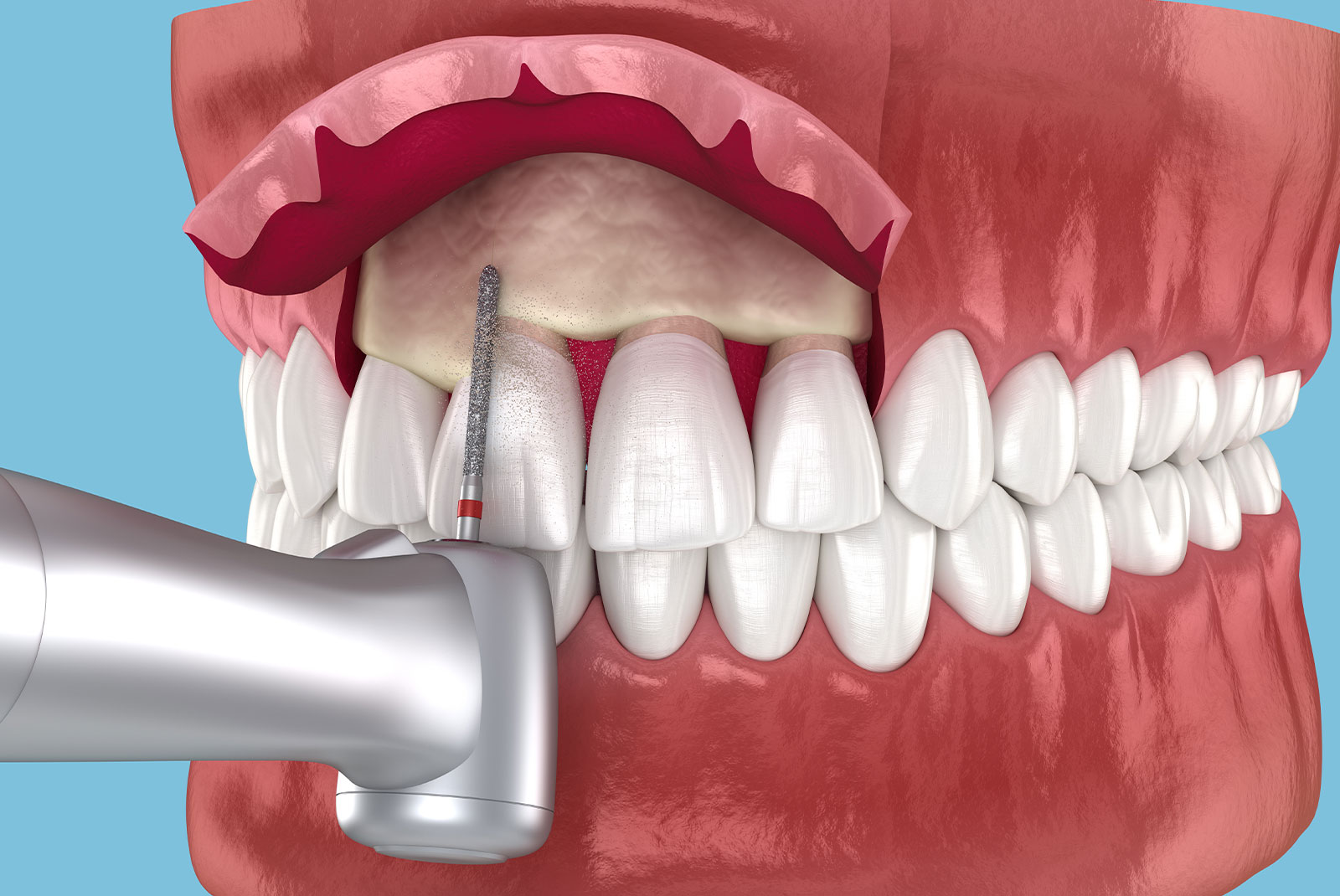 cron lengthen illustration