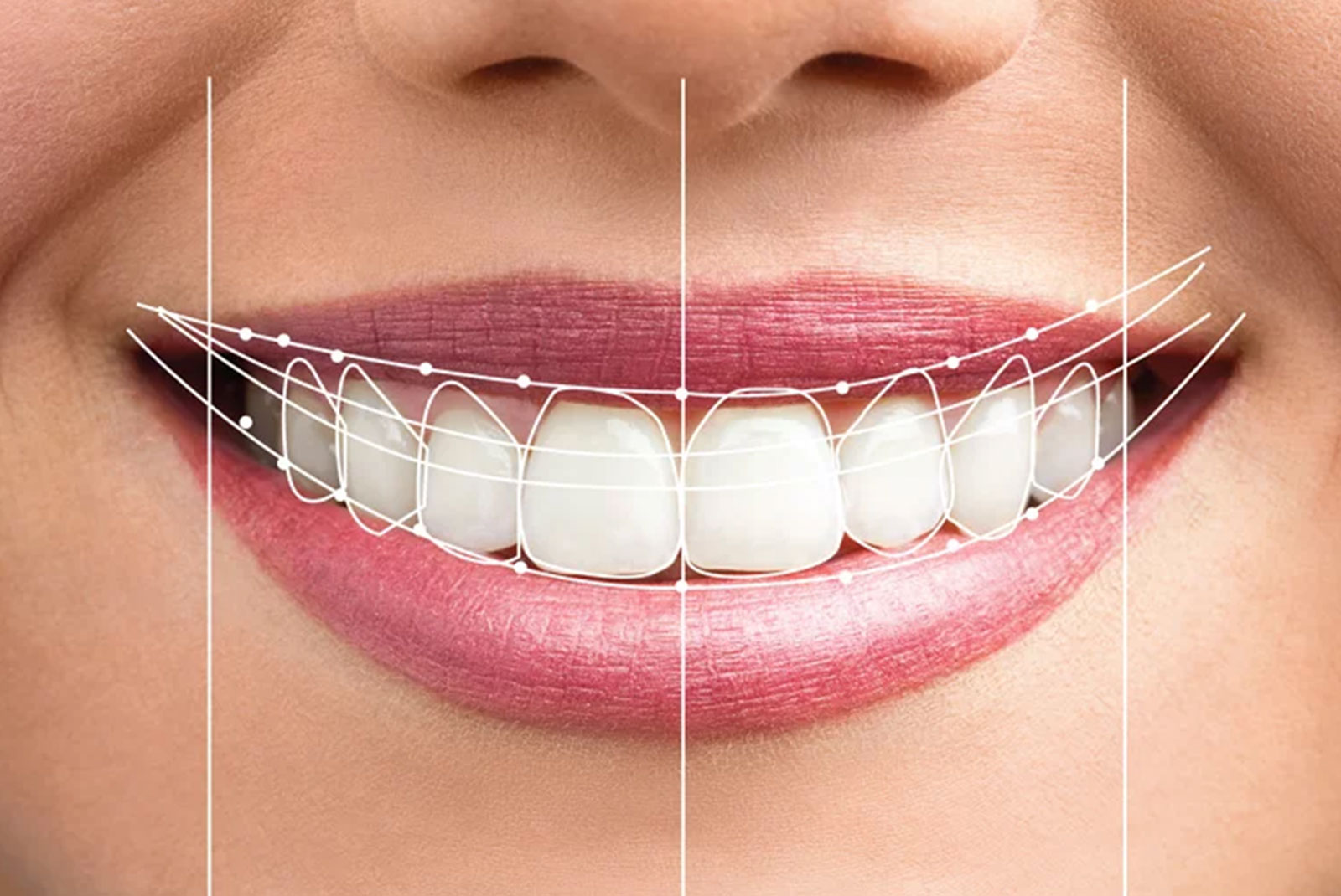 smile design preview close up