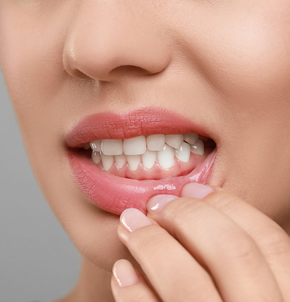 person stretching their lips to examine their gum