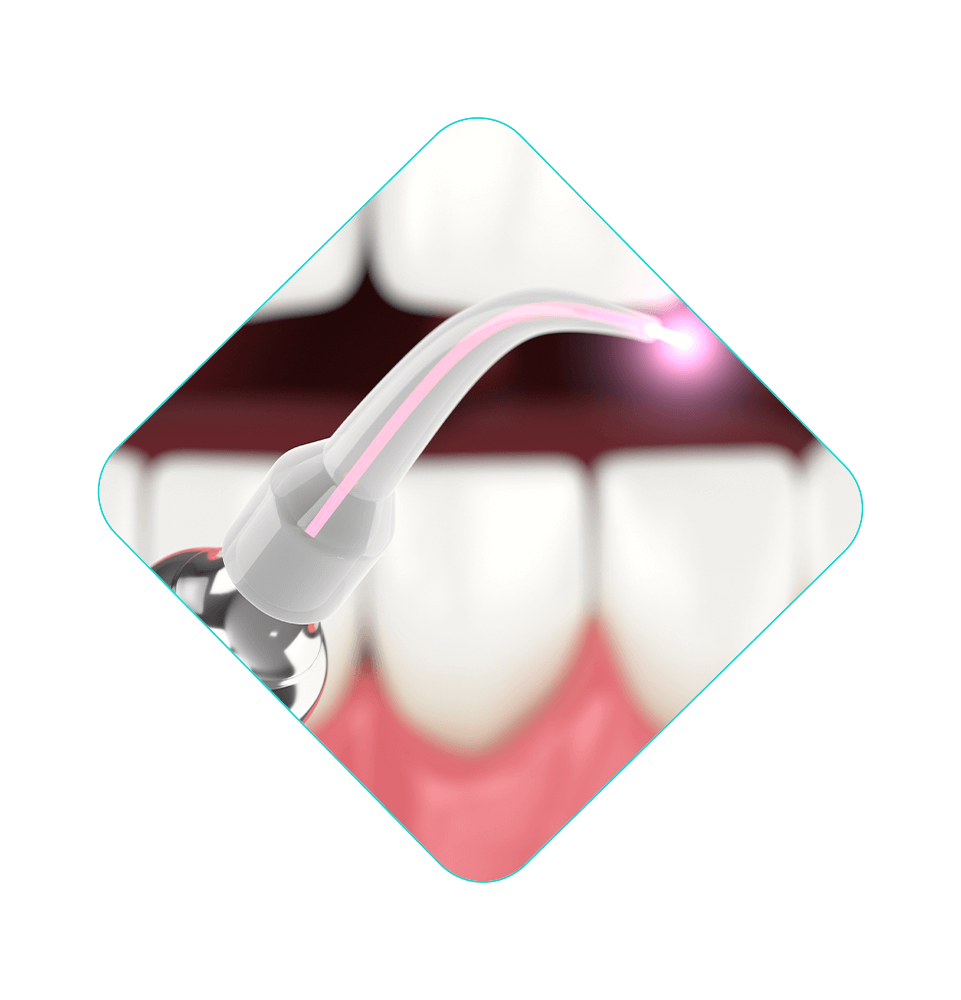 Close up laser dental device