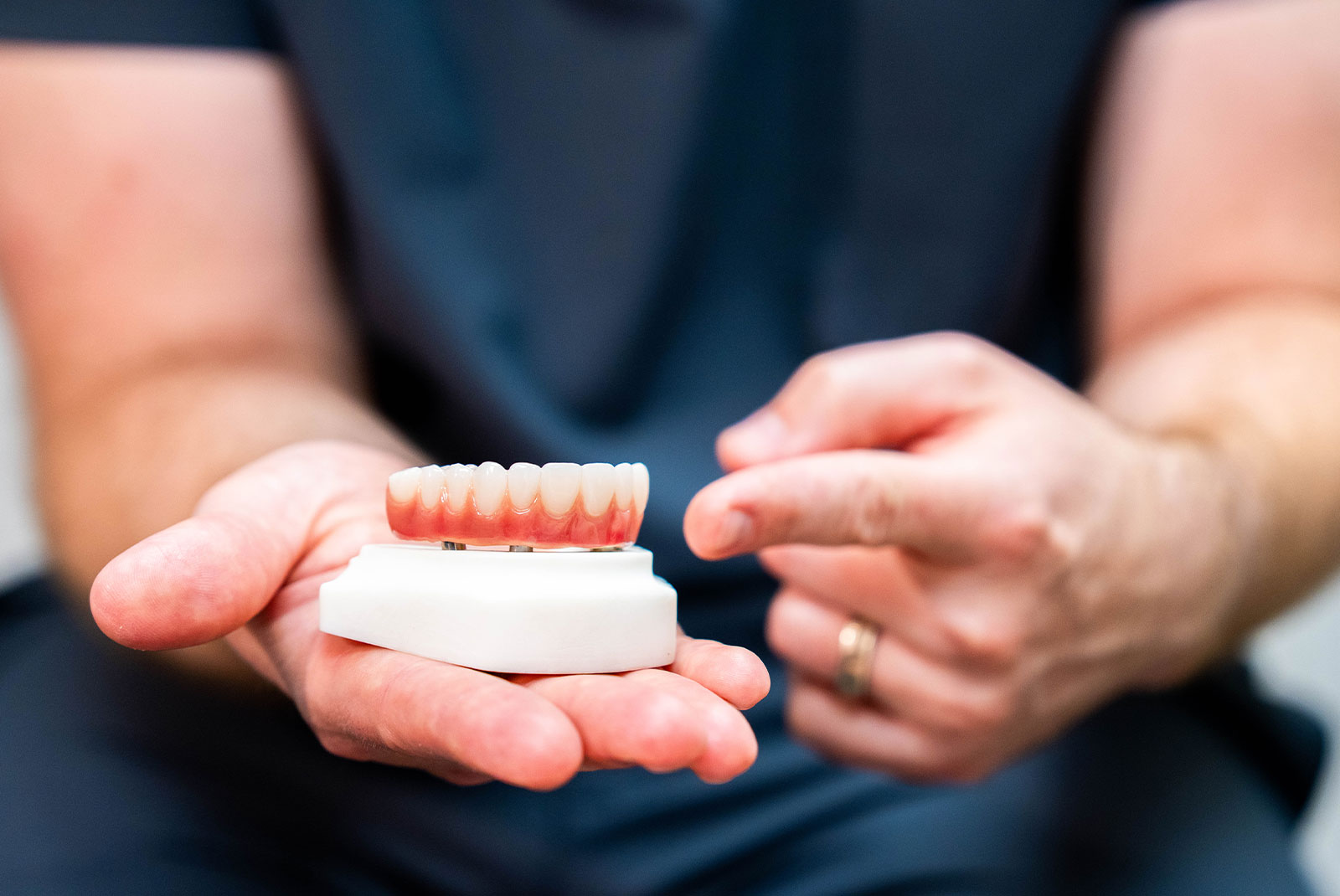 close up of doctor holding full arch dental implant model