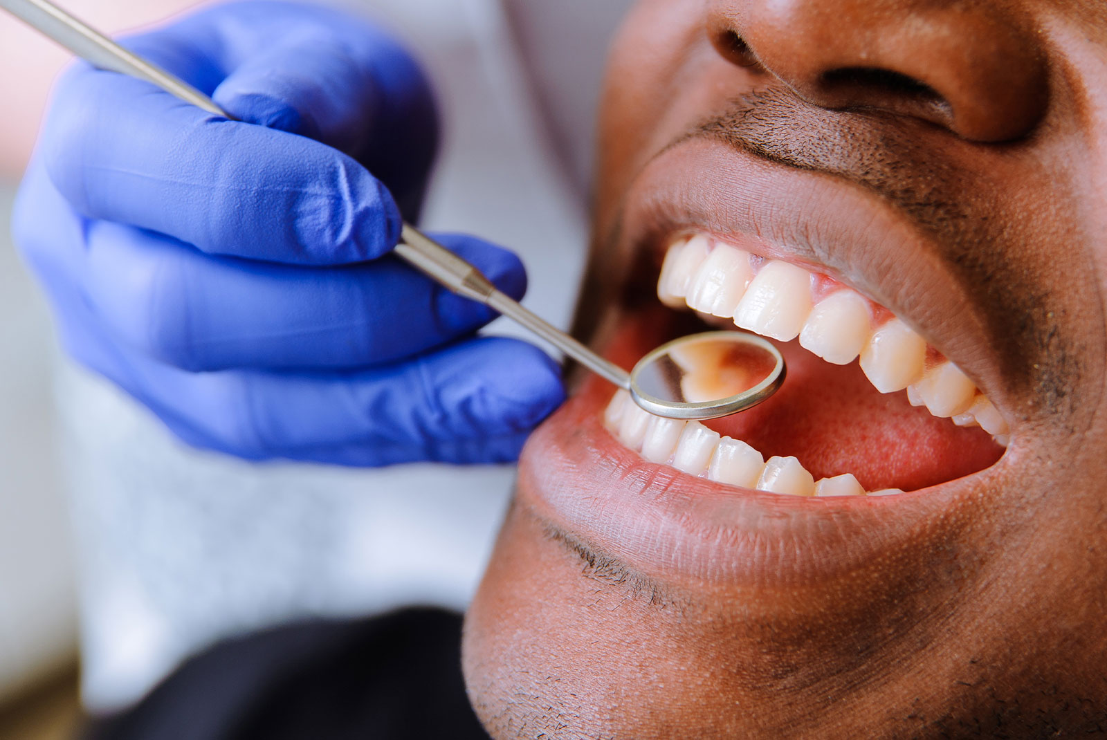 close up of person having their mouth examined