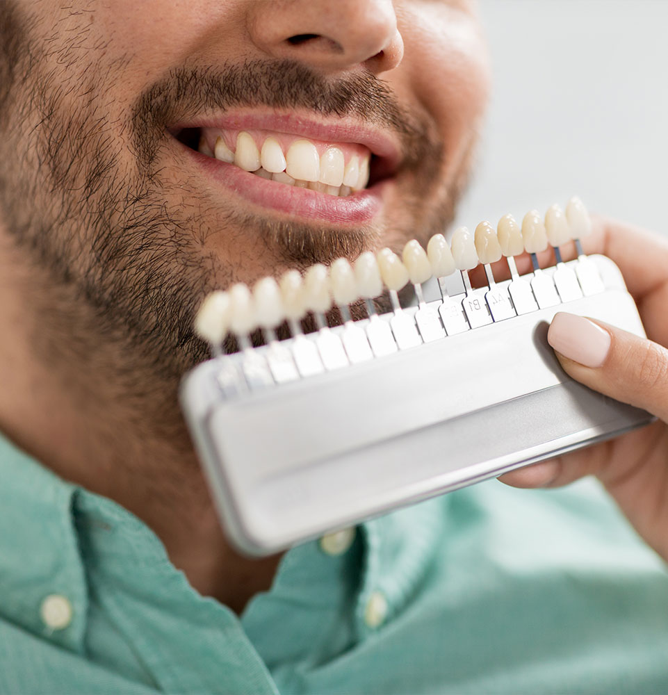 close up of dental patient having a whitening scale