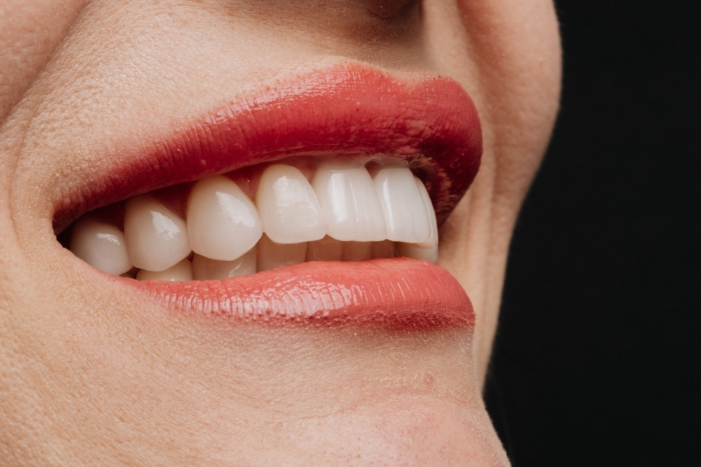 smiling women with shite teeth and red lips in dental office
